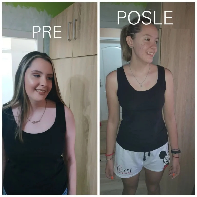 Pre i posle slika klijenta